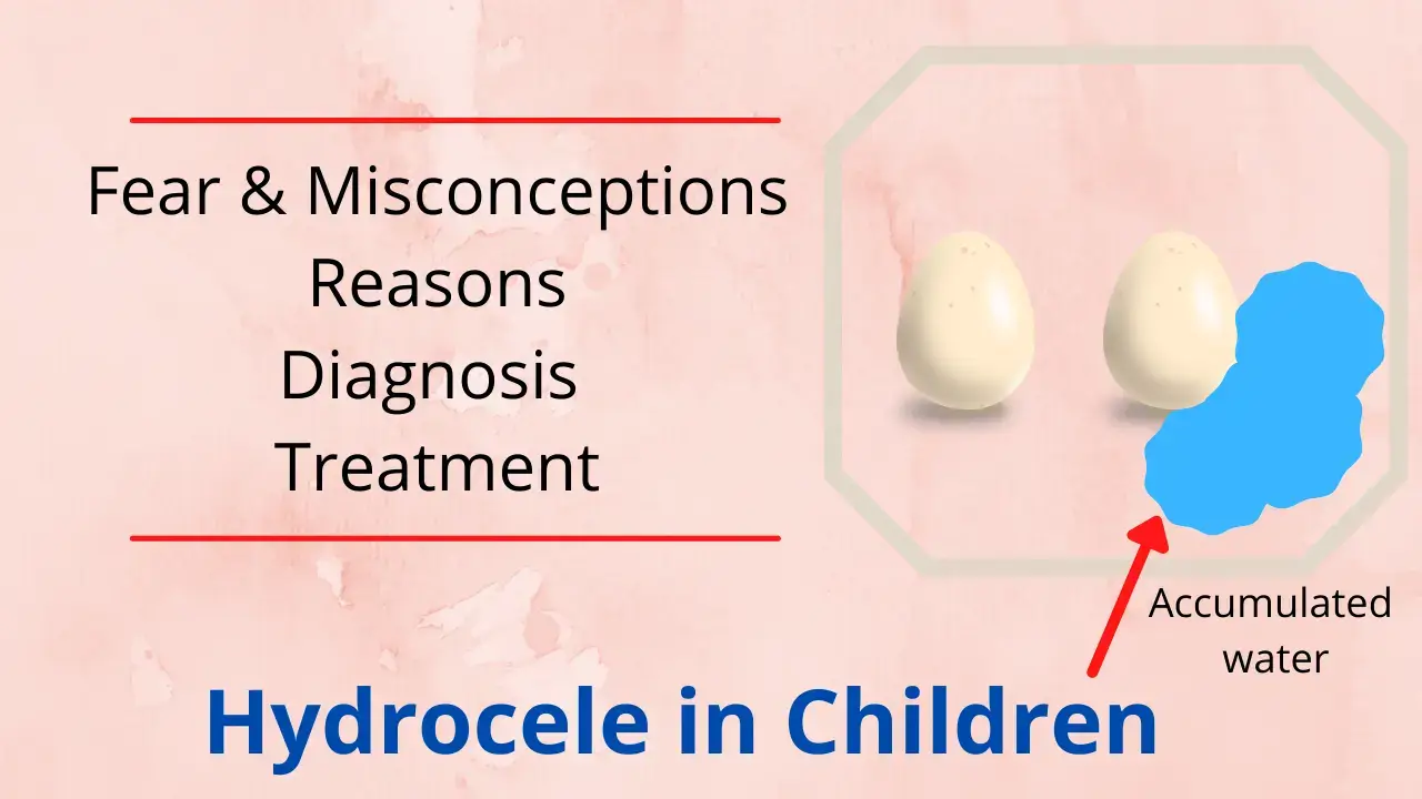 hydrocele in children