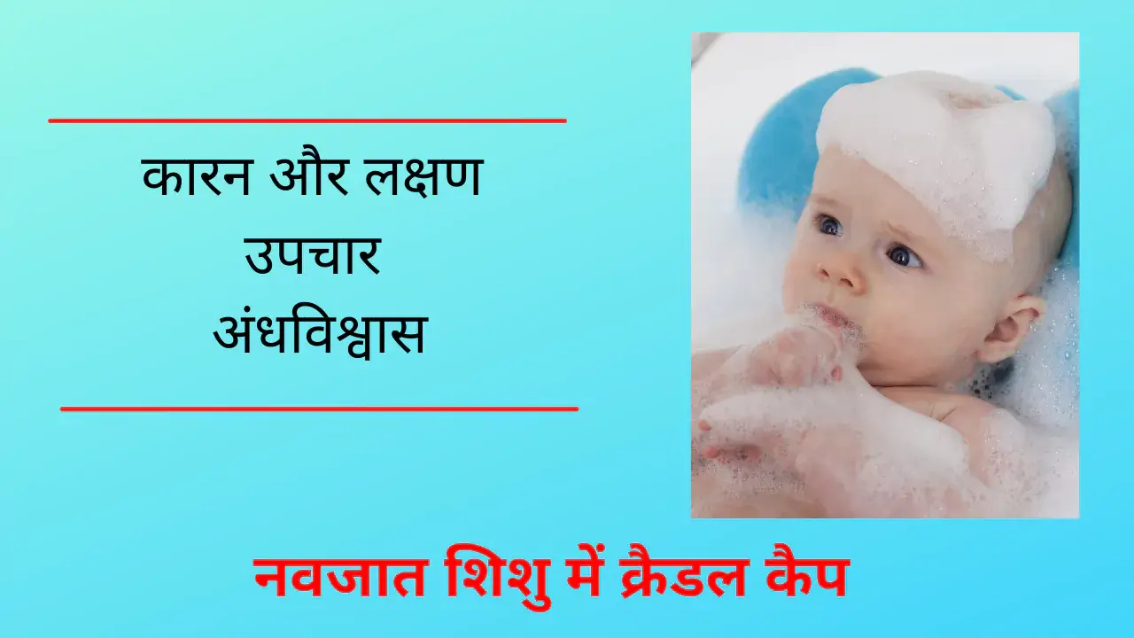 cradle cap in hindi