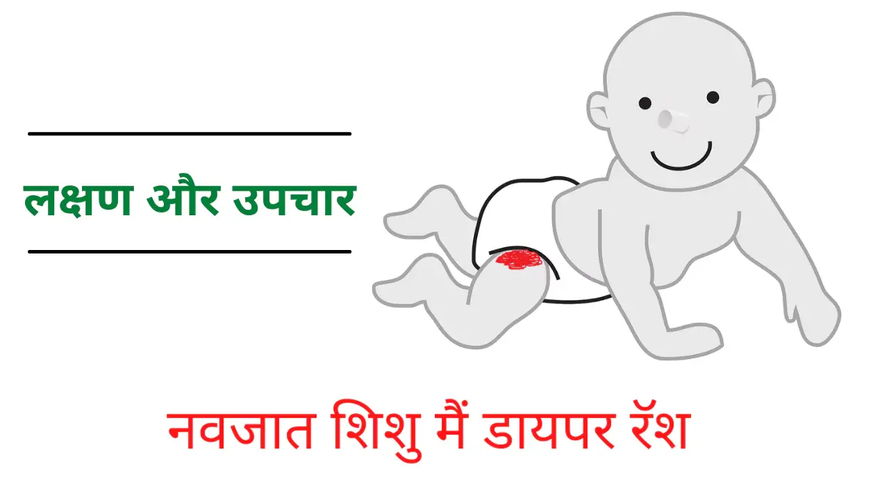 diaper rash in hindi