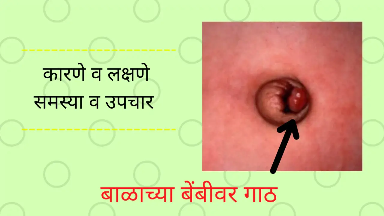 umblical granuloma in newborn baby