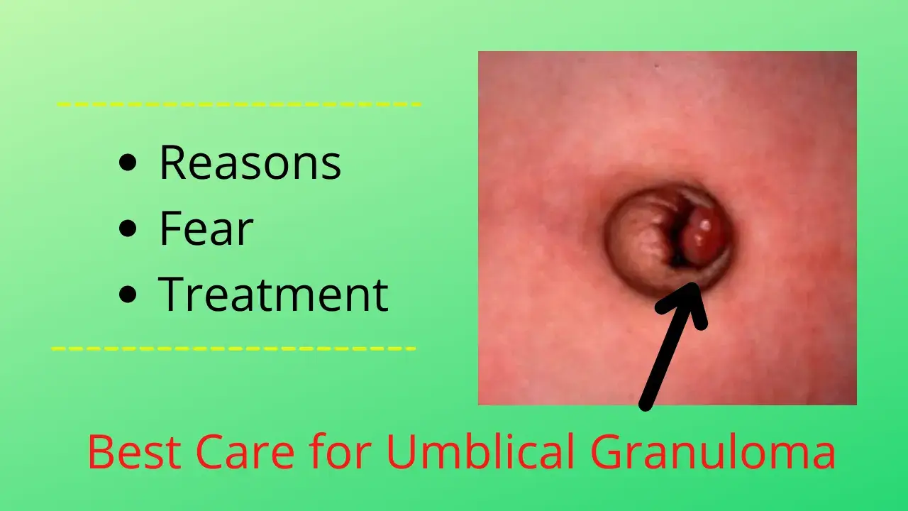 umblical granuloma in newborn baby