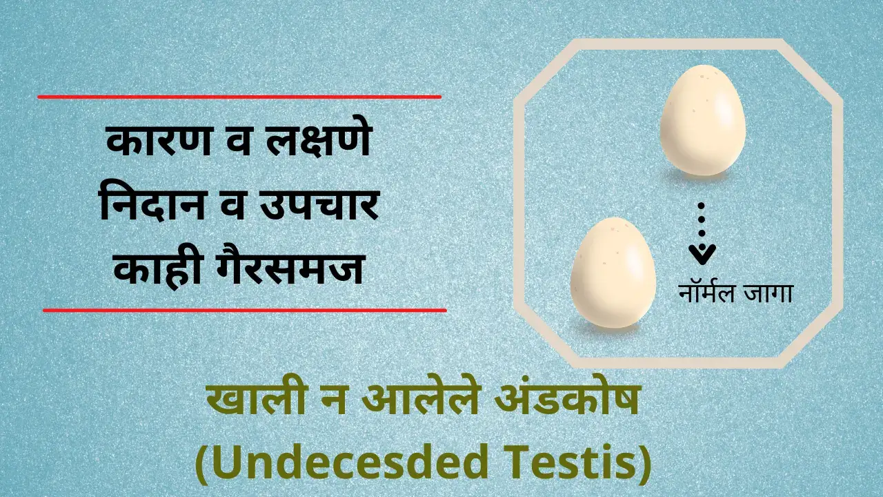 undescended testis in marathi