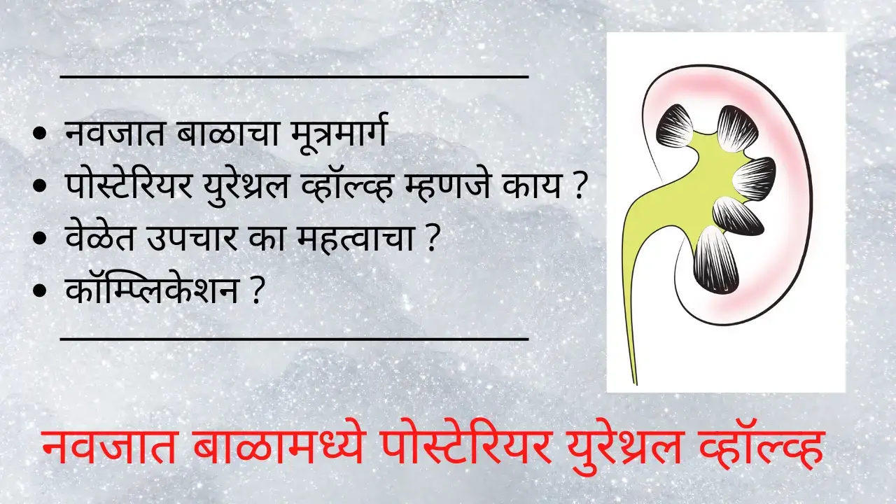 posterior urethral valve in marathi
