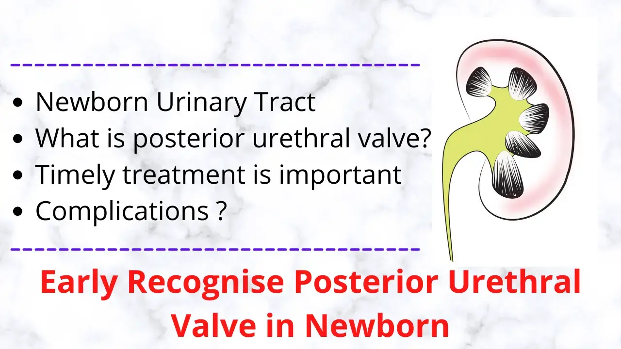 posterior urethral valve in newborn