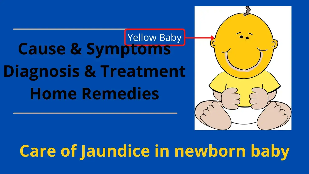 jaundice in newborn
