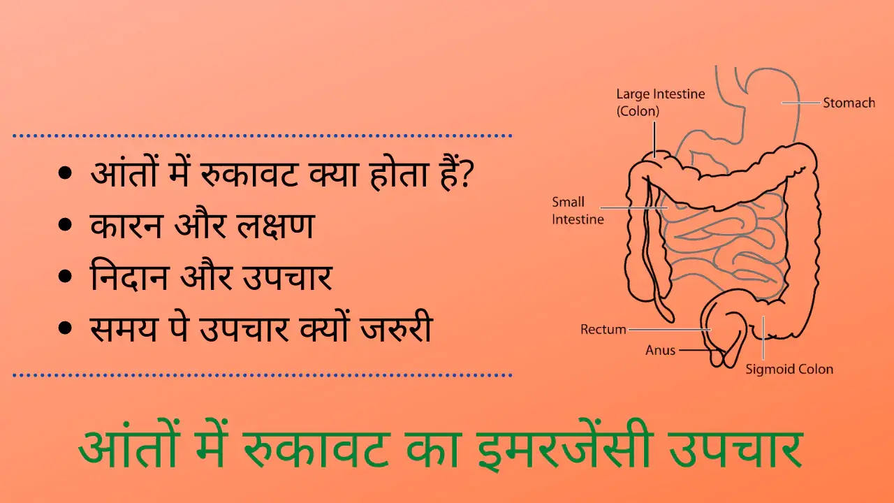 intestinal obstruction in hindi