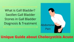 cholecystitis acute
