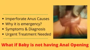imperforate anus in newborn