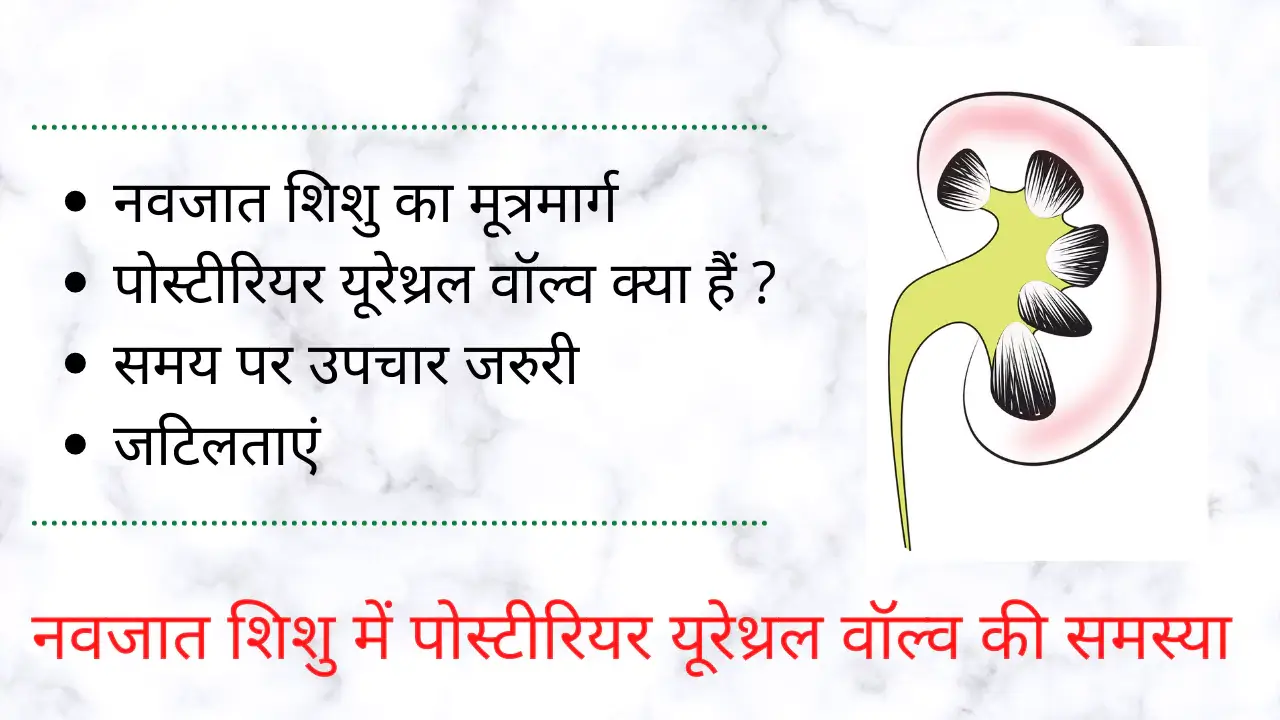 posterior urethral valve in hindi