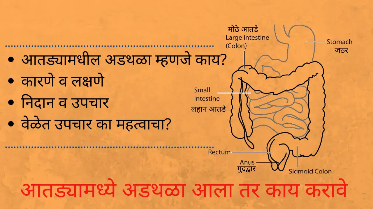 intestinal obstruction in marathi