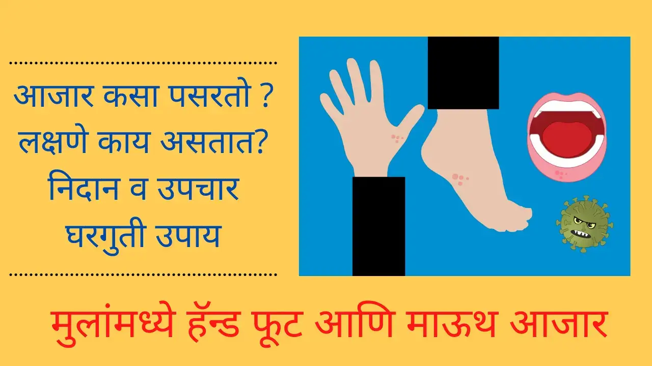 hand foot and mouth disease in marathi